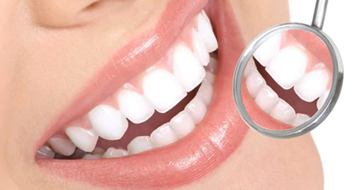 Teeth Whitening Elmhurst