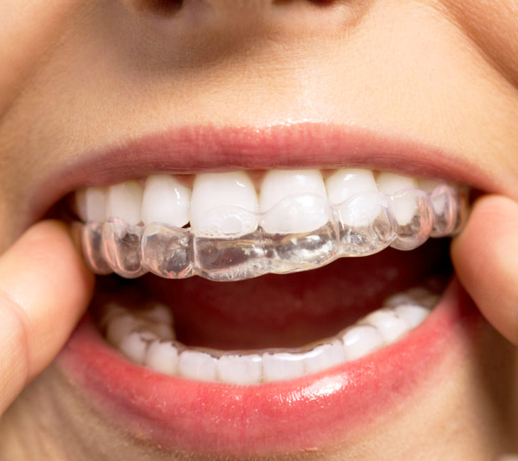 clear alinger elmhurst il