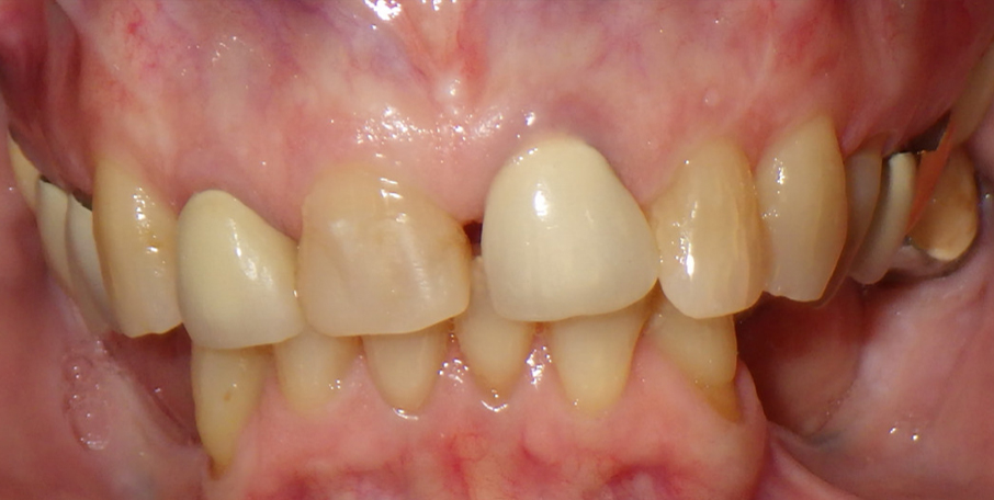 Smiles Before Treatment 