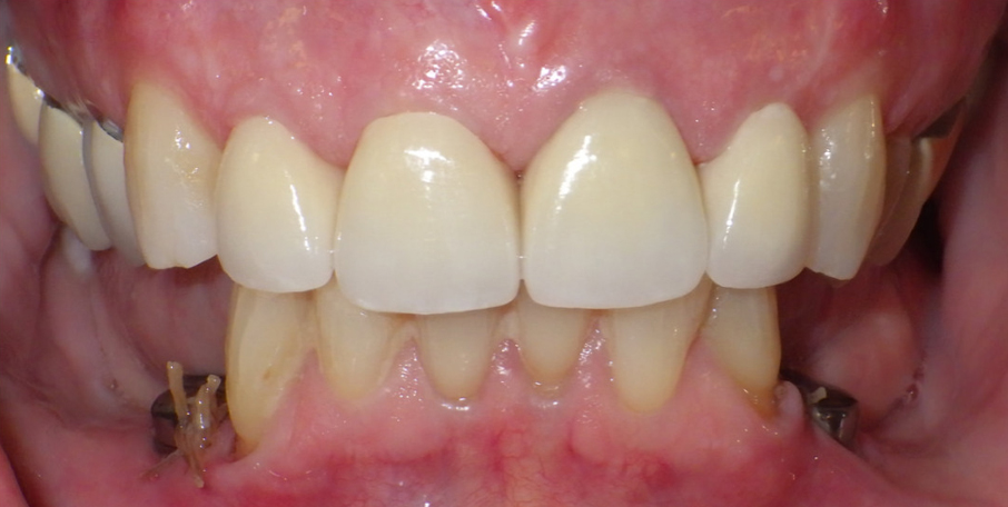 Smiles After Treatment