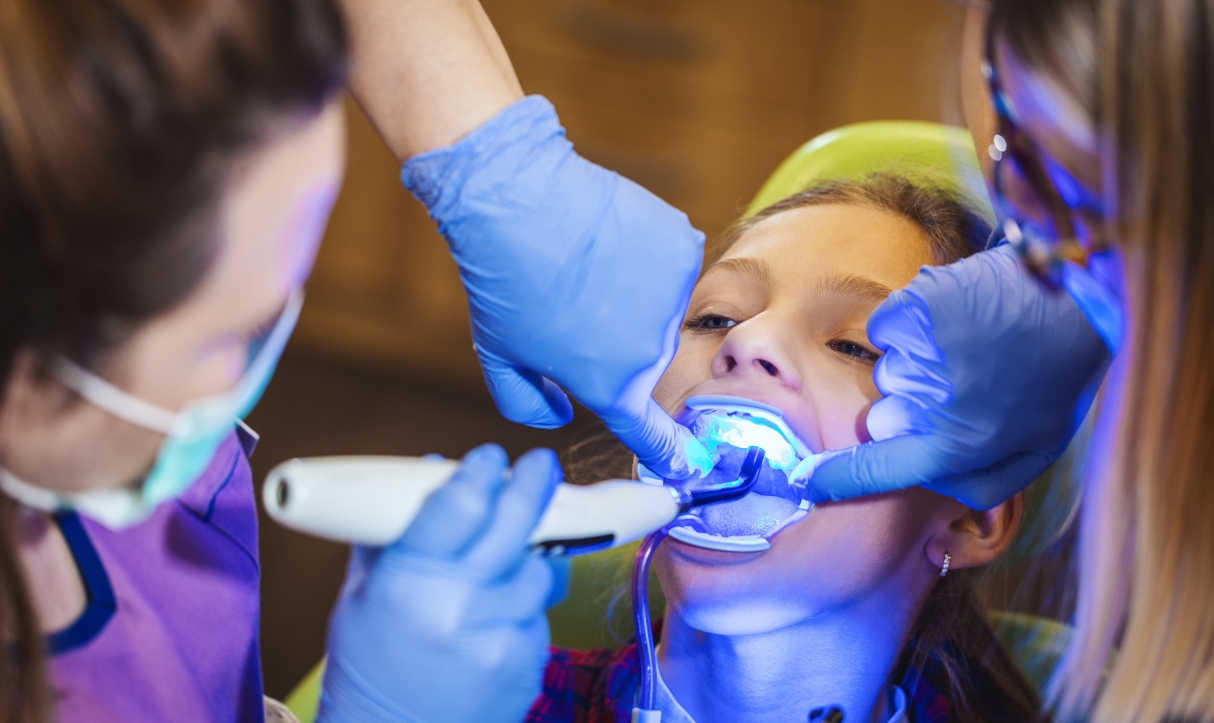 why teeth whitening is the best post-halloween treat you can give yourself