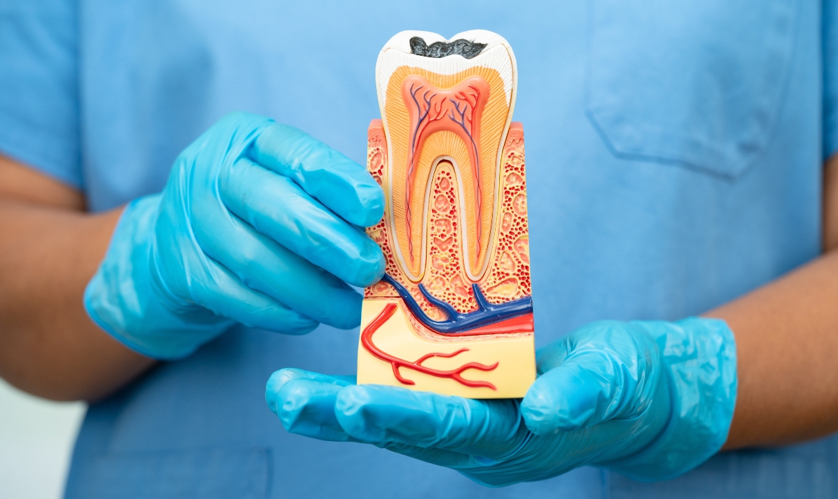common myths about root canals what’s true and what’s not
