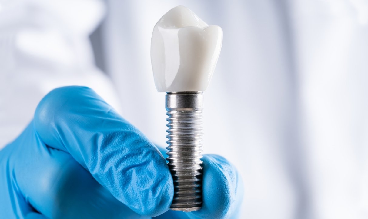how dental implants can fix loose or missing teeth