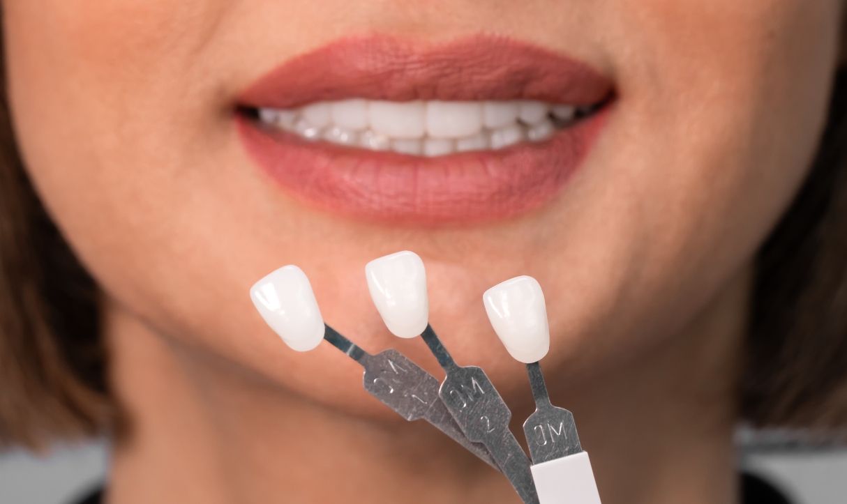 the possible reasons for pain after getting dental veneers